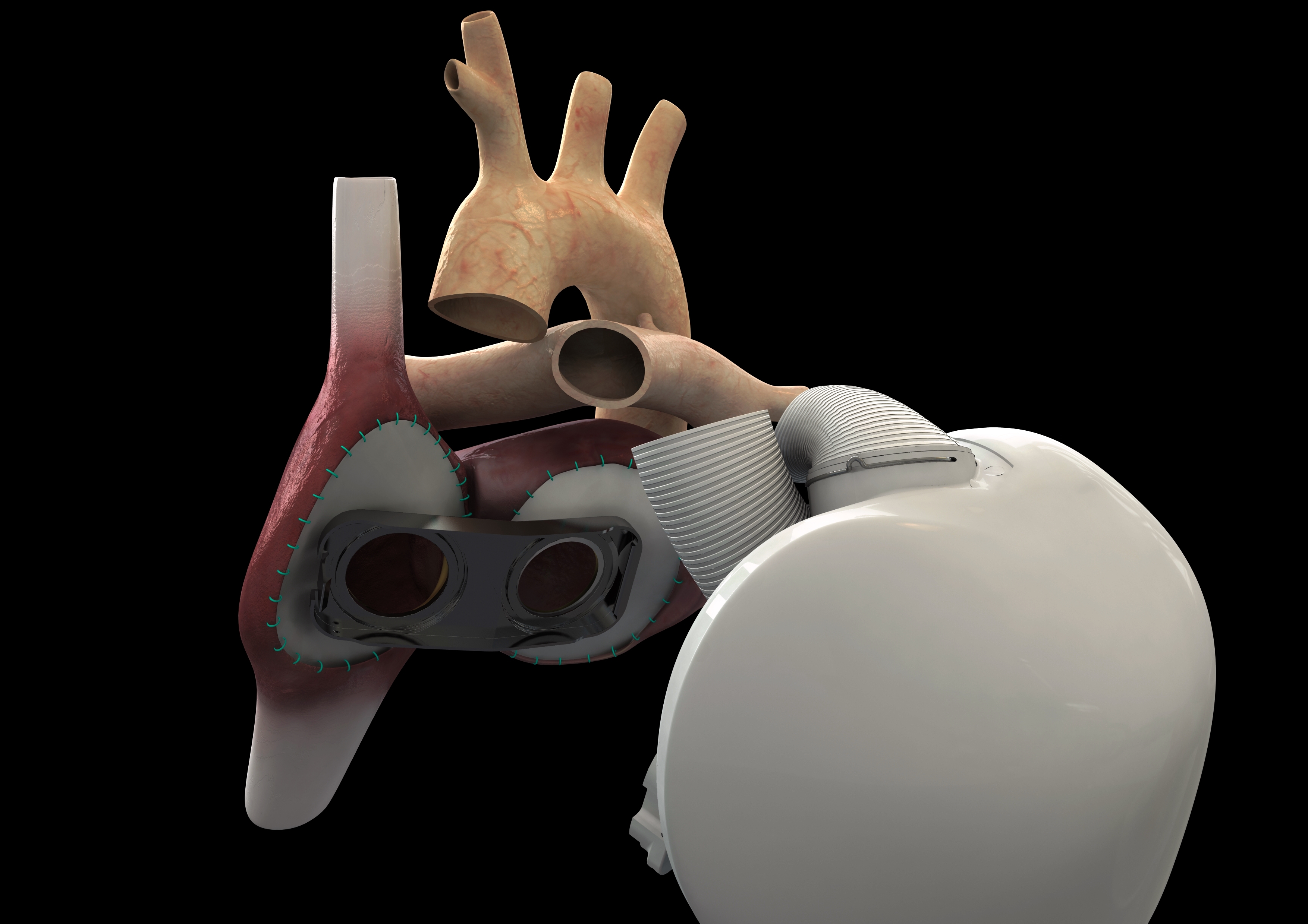 Medical Xpress