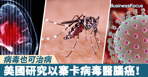 【以毒攻毒】病毒也可治病！美國研究以寨卡病毒醫腦癌！