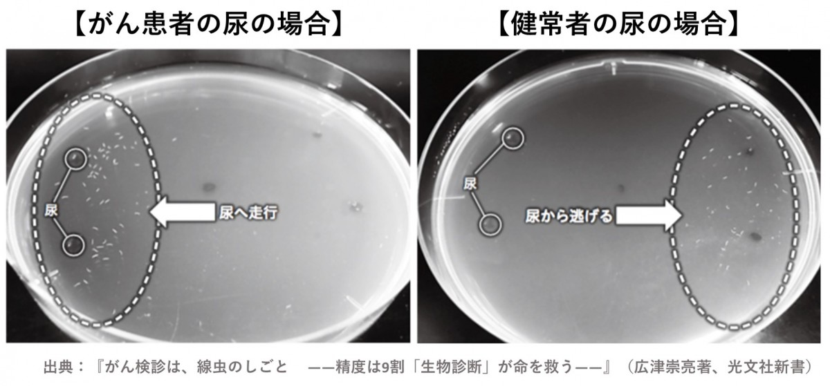 日本 檢驗 癌症 一滴尿