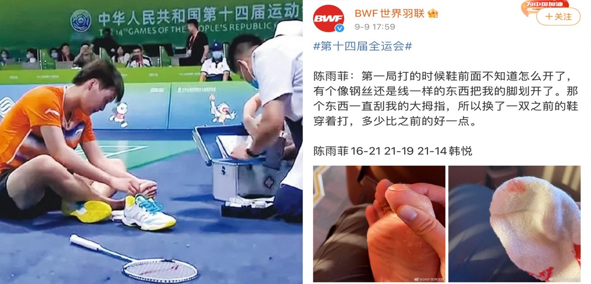 羽毛球手陳雨菲受傷事件，令李寧股價受壓。