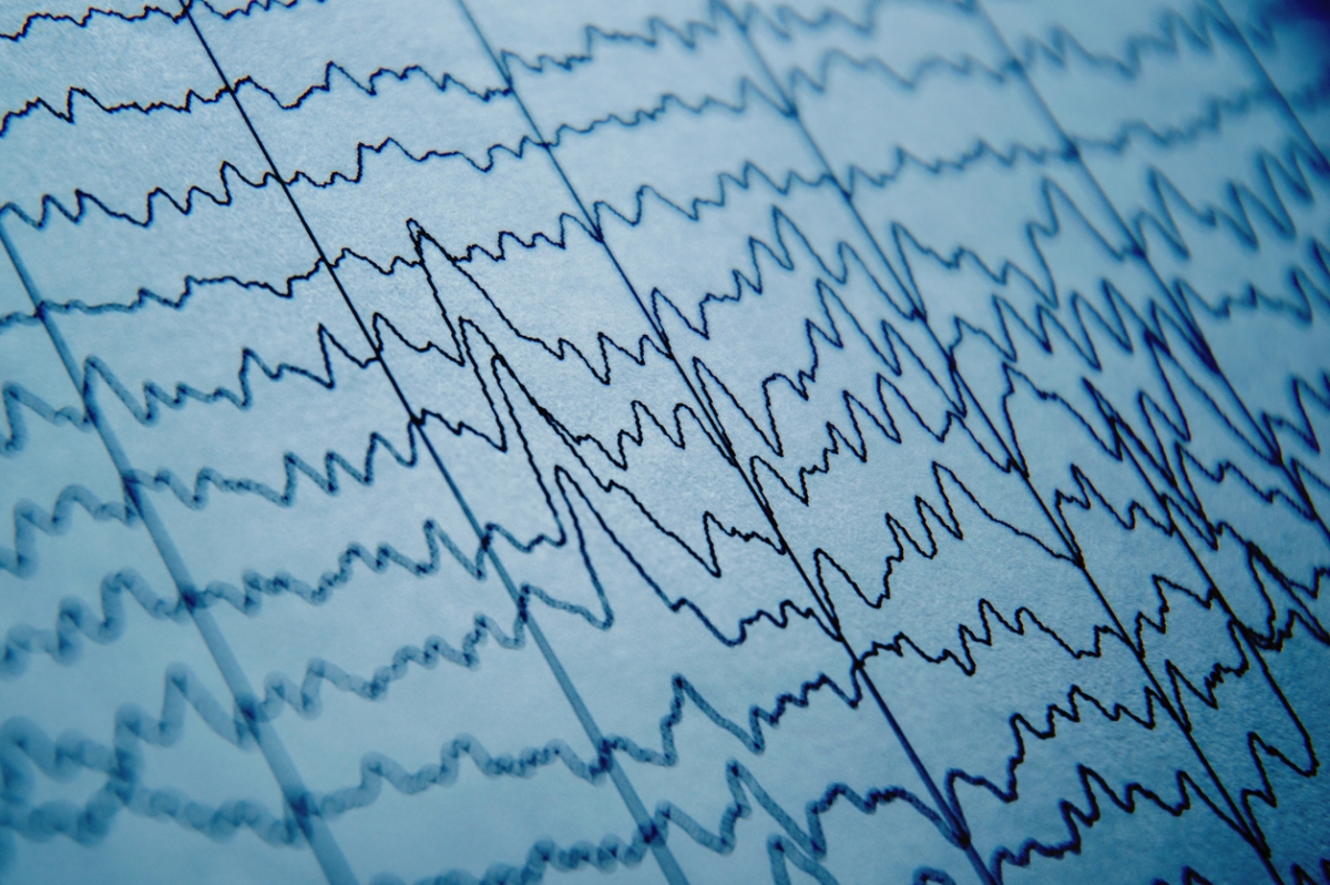 美國意外記錄人類垂死前的大腦活動，發現人類臨終前或確實會浮現俗稱「人生跑馬燈」的生前各種經歷。