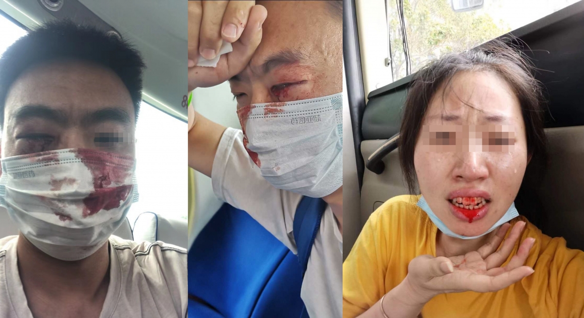 多名維權的小存戶疑被打至頭破血流。