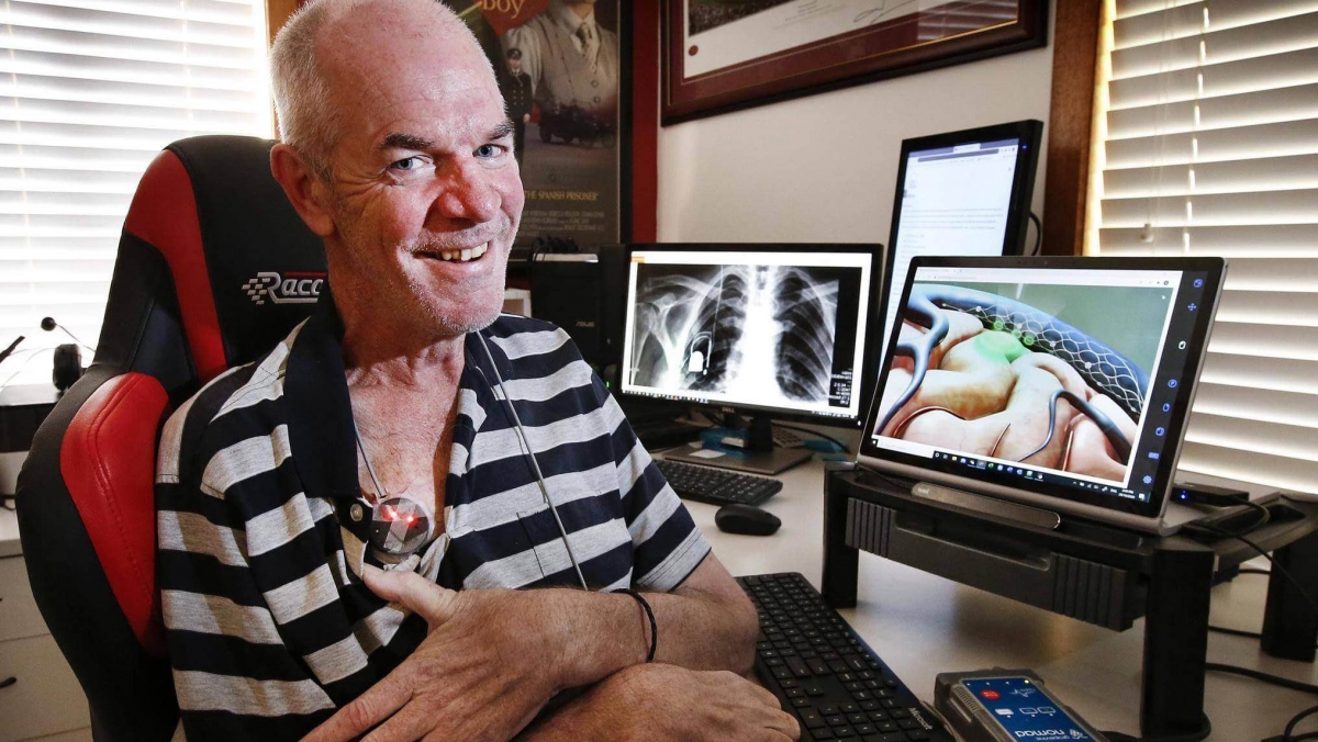 Synchron是於去年獲得美國食品及藥物管理局（FDA）的批准，同年一名曾接受植入手術的患者更是藉助腦機介面，成功發佈全球首則透過意念撰寫的推文。