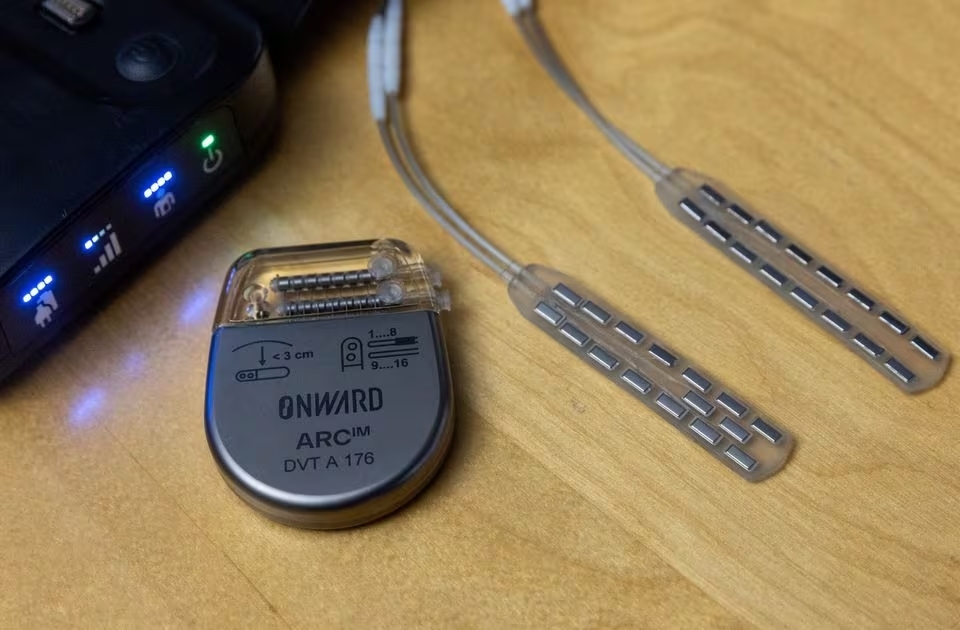 患者在脊椎植入電極後，只需要佩戴可手動開關的刺激器裝置，就可恢復正常運動，包括伸展無力的膝蓋及收縮臀部肌肉。