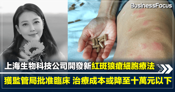 上海生物科技公司  開發新紅斑狼瘡細胞療法  獲監管局批准臨床  治療成本或降至十萬元以下