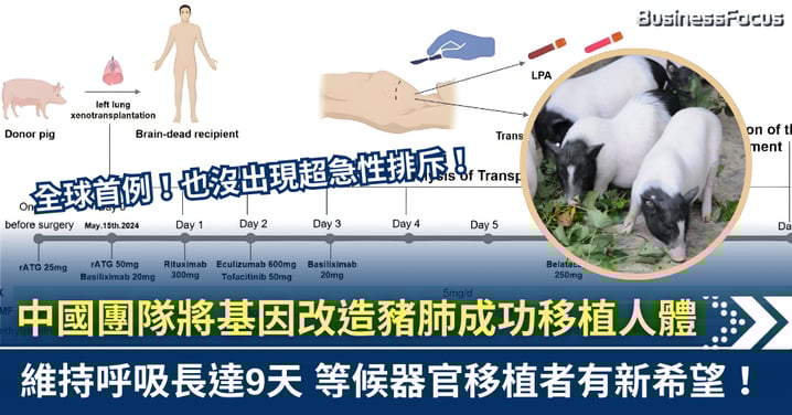 中國創全球首例 基因改造豬肺成功移植人體 維持呼吸長達9天