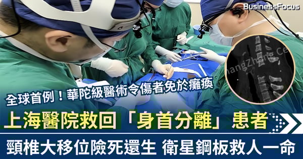 上海醫院創全球首例 救回「身首分離」患者 衛星鋼板技術救回一命